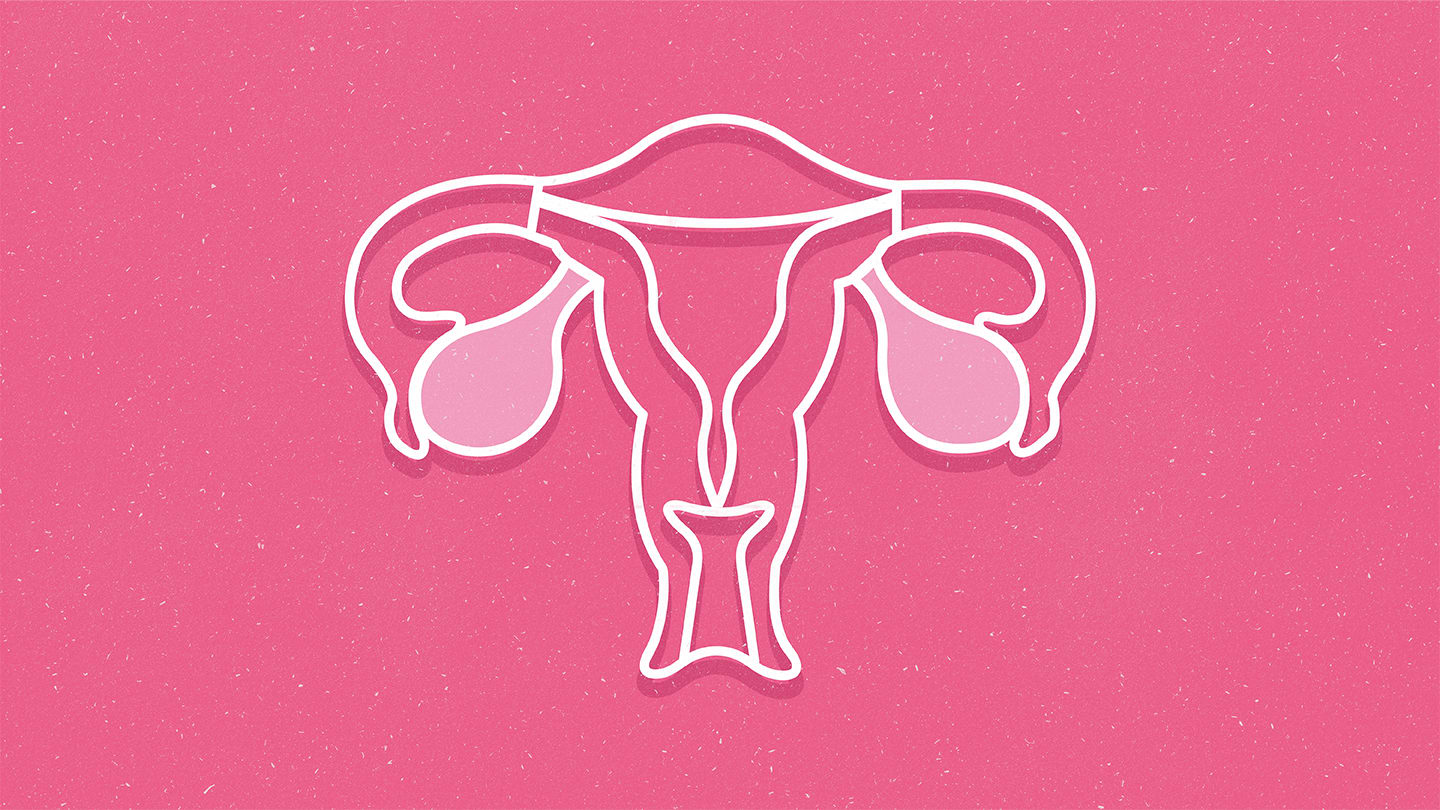 New Therapeutic Target Found in Ovarian Cancer