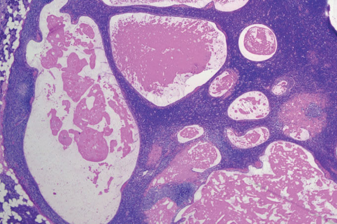 Case of the Month (4)
