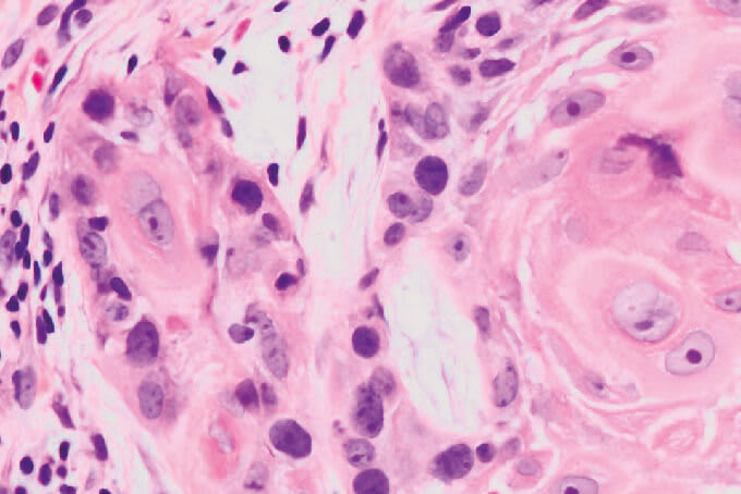 Kill Command for Cancer