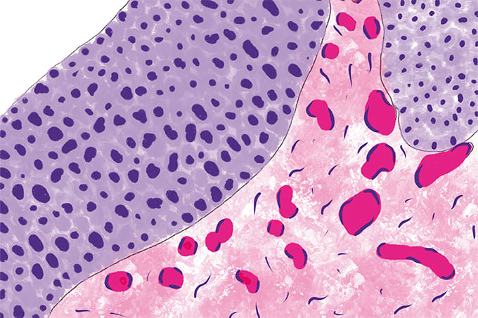 Pathodoodles: Adding Color to the World of Pathology