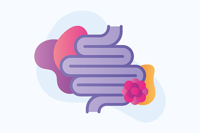 Getting Ahead of the Colorectal Curve