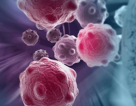 High-performance molecular tumor profiling solution for difficult FFPE samples
