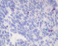 Detection of immune cell checkpoint and functional markers in the tumor microenvironment