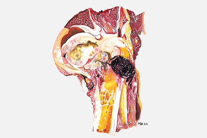 Power List Year Pathology on Canvas