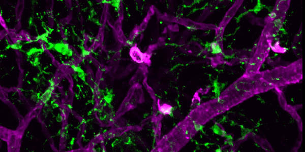 The Magic of Microglia