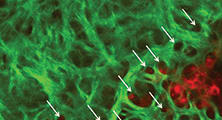 Corneal Anatomy: Lightning Strikes Twice