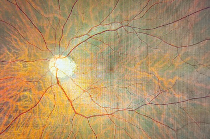 The (Unknown) Power of Retinal Imaging