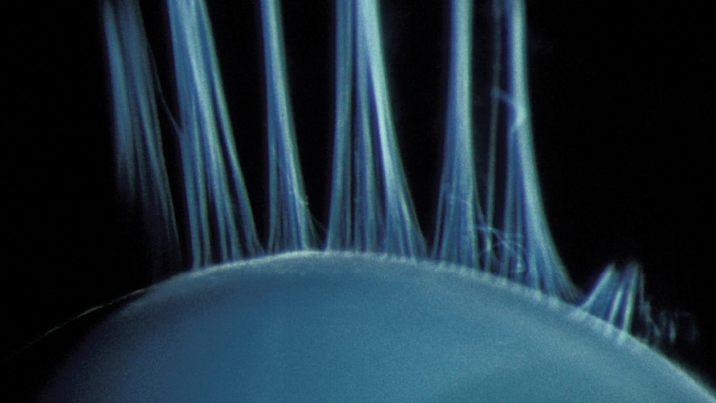 Haag-Streit Slit Lamp Imaging Competition Winners 2025