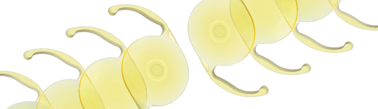 Breaking Barriers on Presbyopia Correcting Surgery