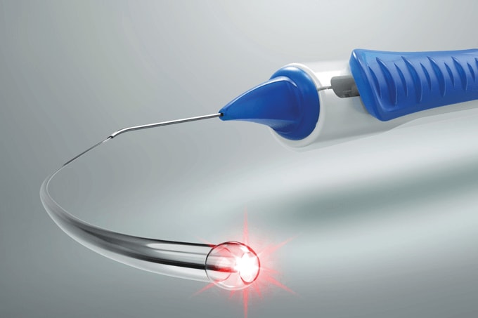 A Glaucoma Advance In More Than Just Name