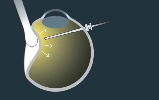 ViPer: Indentation and Illumination in One Hand
