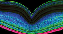 Discovering Cellular Structures of the Retina: Then and Now
