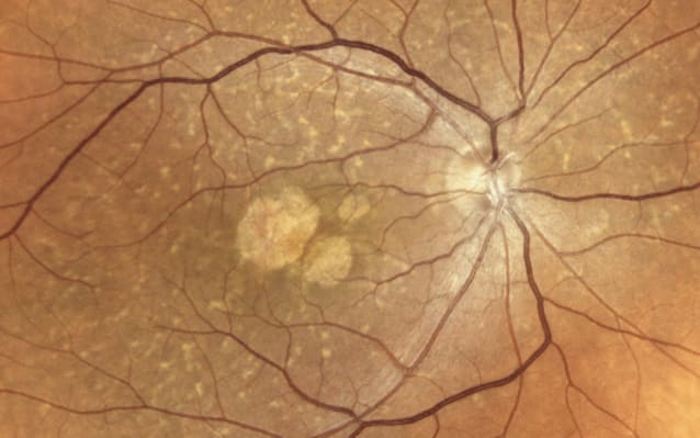 Ultra-High Fidelity Fundus