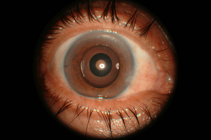 Extending Surgeon Expectations