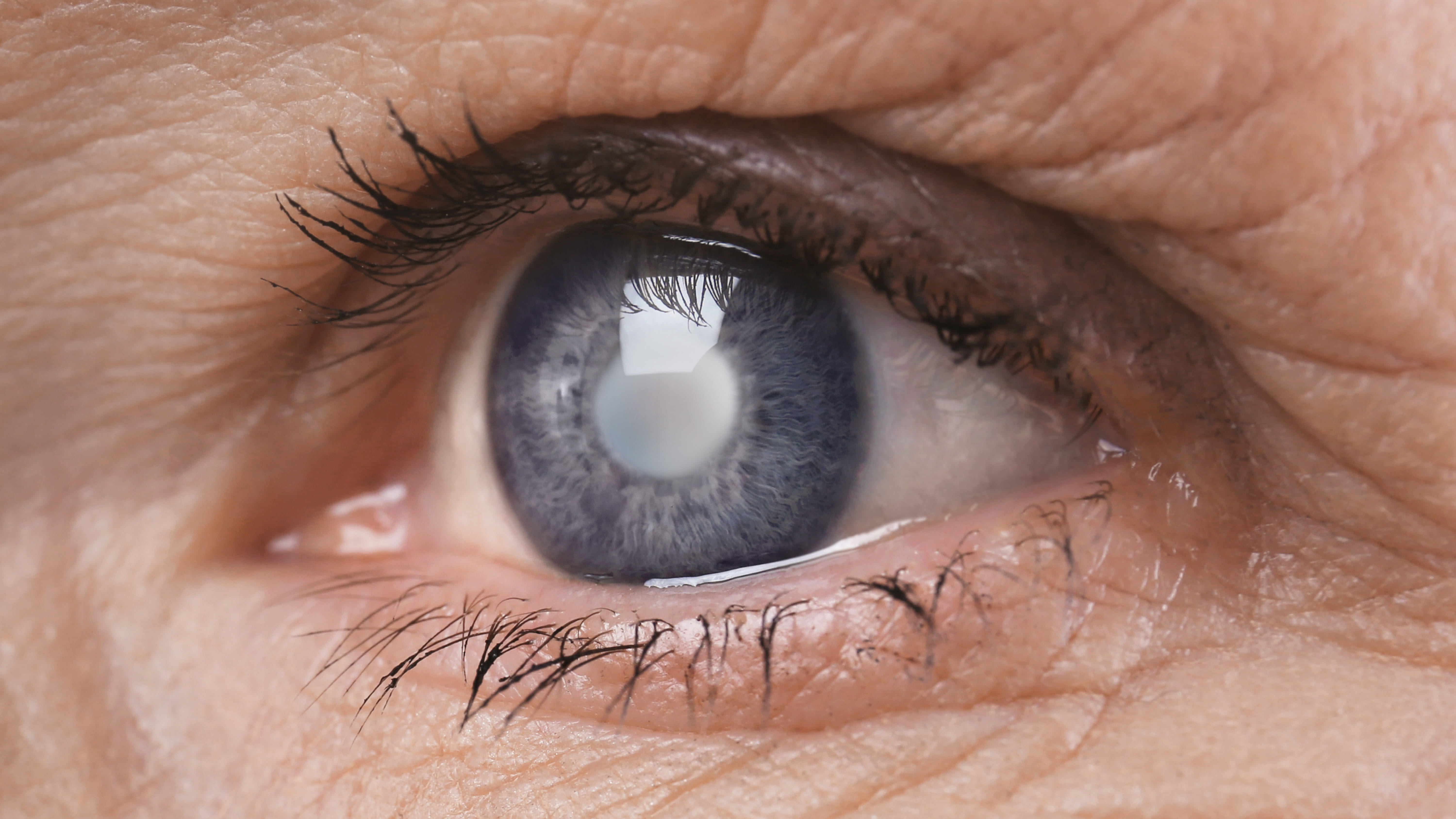 Unraveling Cataracts Molecular Origins