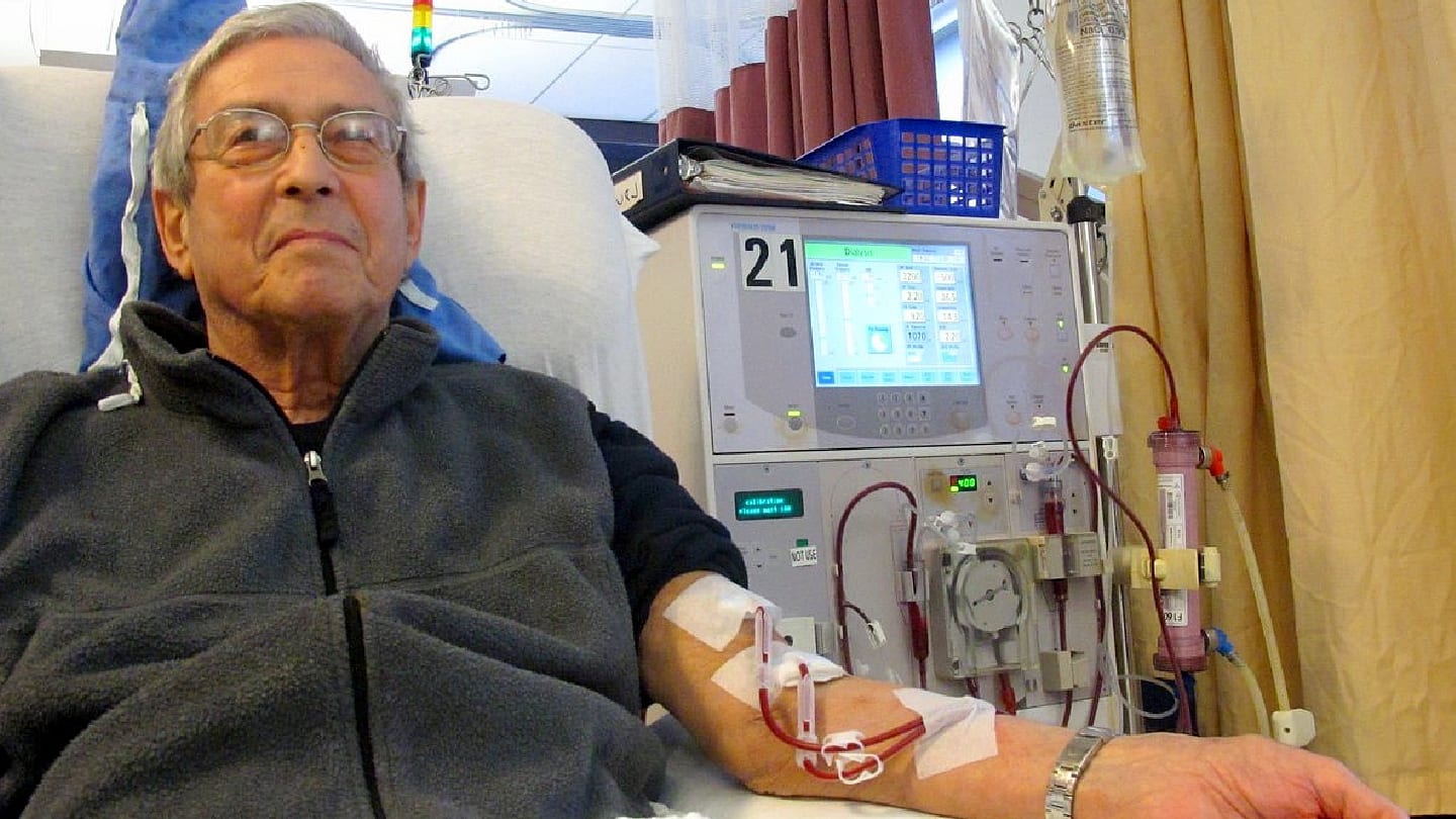 IOP Spikes During Hemodialysis