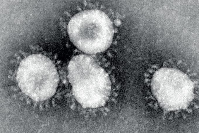 All Eyes on Coronavirus