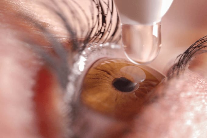 A Cornea Copia… and Other News