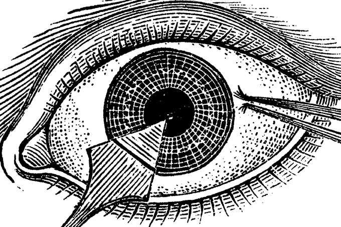 The Ophthalmologist’s Time Machine: Chapter 17