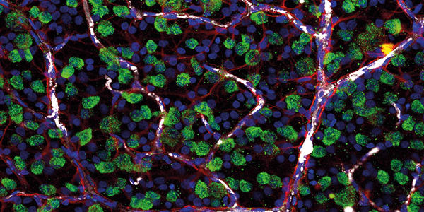 The Astrocyte Fight Against Glaucoma