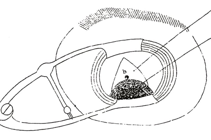 The Ophthalmologist’s Time Machine: Chapter 16