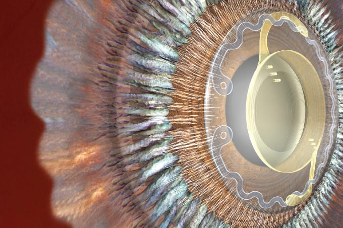 Superior Stability: The MORCHER® EyeJet® TYPE 20