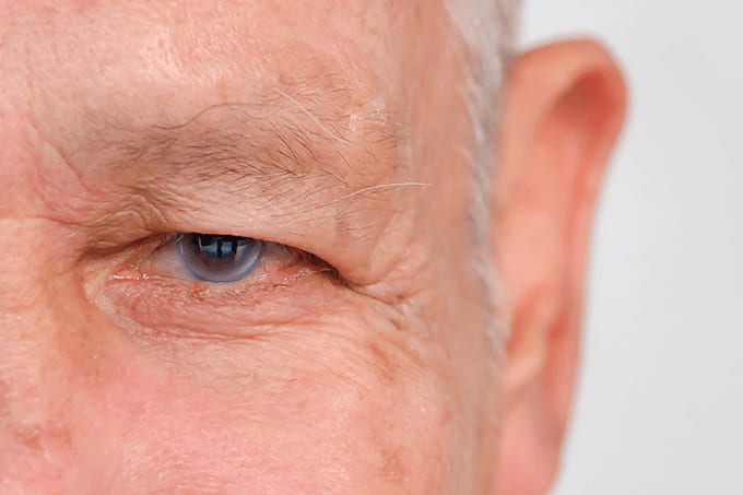 Biomechanics for Glaucoma… and Other News
