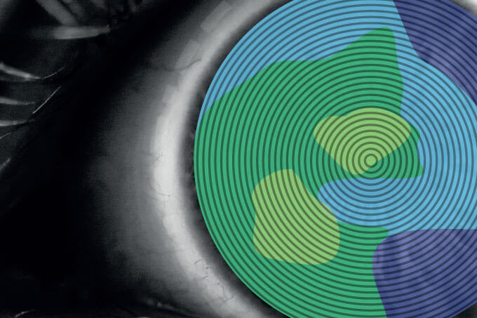 Keratoconus Screening