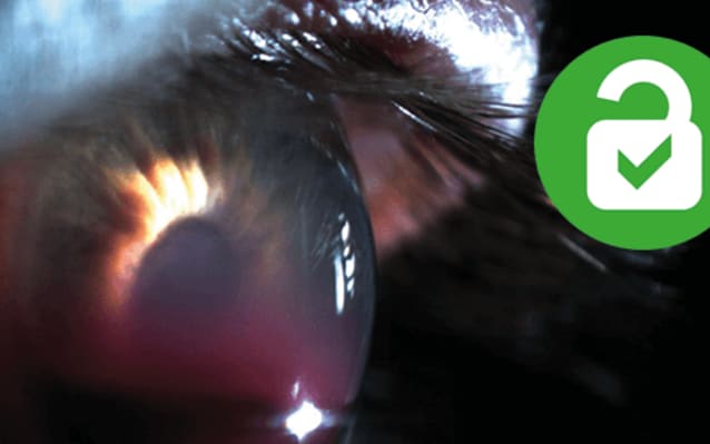 The Art of Eyes: Anterior segment