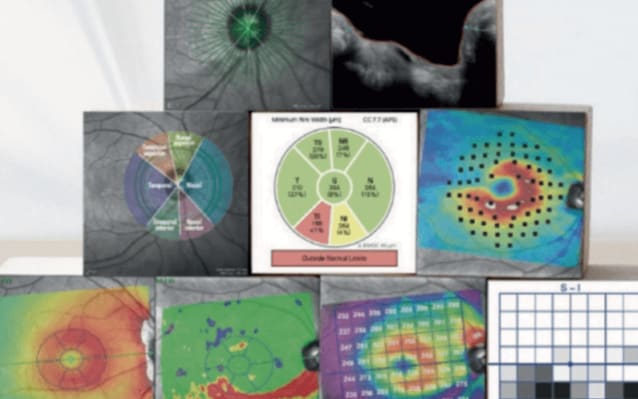 Enhanced Features, Enhanced Diagnostics