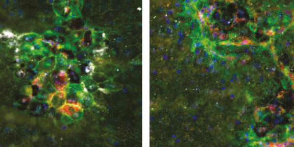Enter the Inflammasome