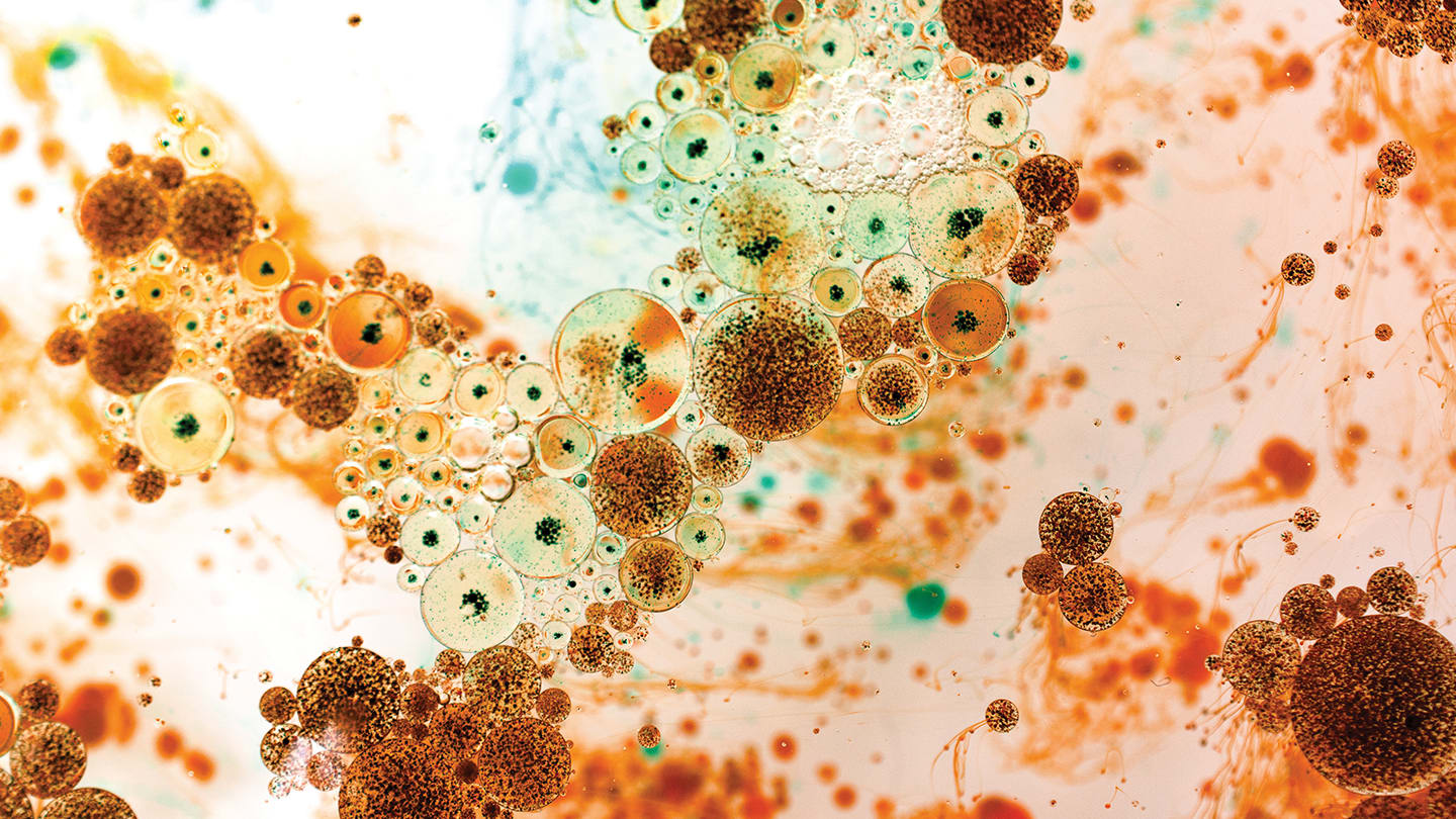 Look Again! Demodex Blepharitis in Closer Focus