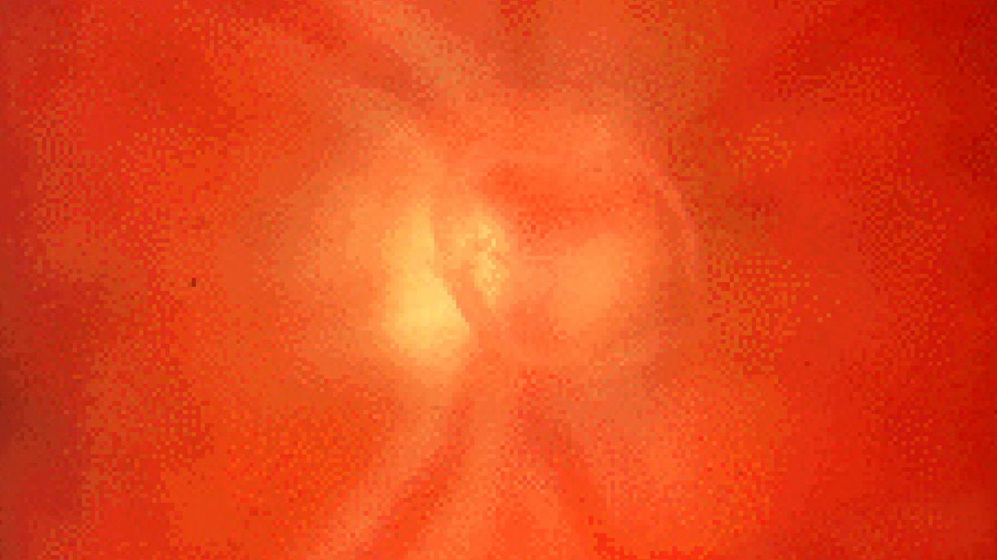 Floaters More Predictive Than Flashes