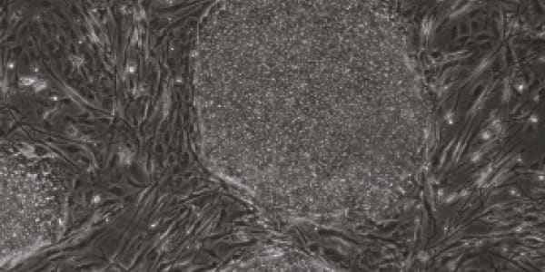 Long Live the Stem Cell!
