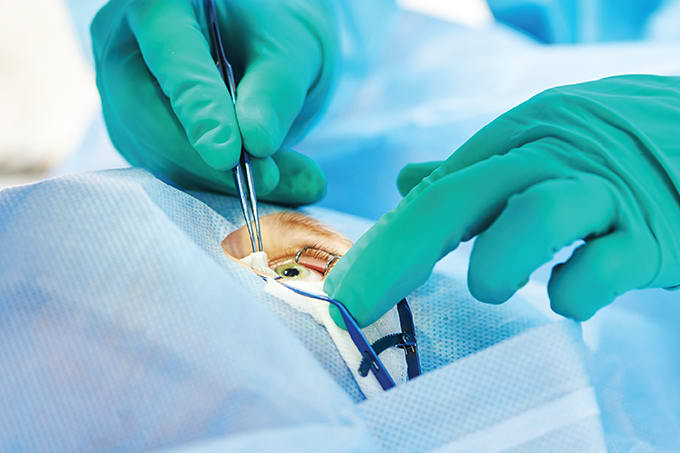 Surgical Tips for Retina, Part 1