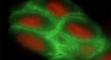 Finding Corneal Limbal Stem Cells for Transplantation Could be as Easy as ABCB5