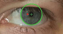 Strabismus Screening – Now There’s an App for That