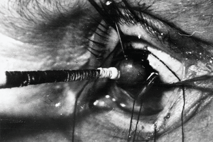 The Ophthalmologist’s Time Machine: Chapter 2