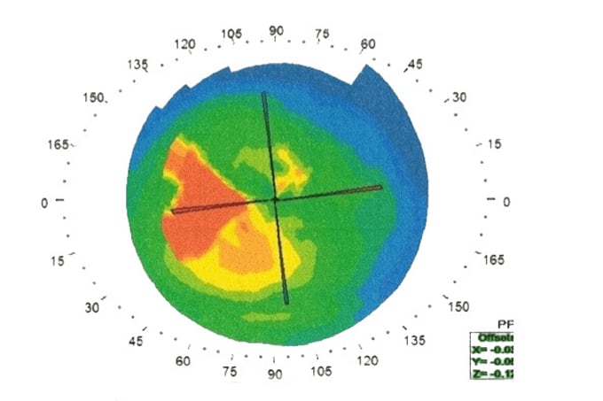 Uncovering Ocular Comorbidity