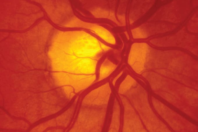 At Risk for ROP… and Other News
