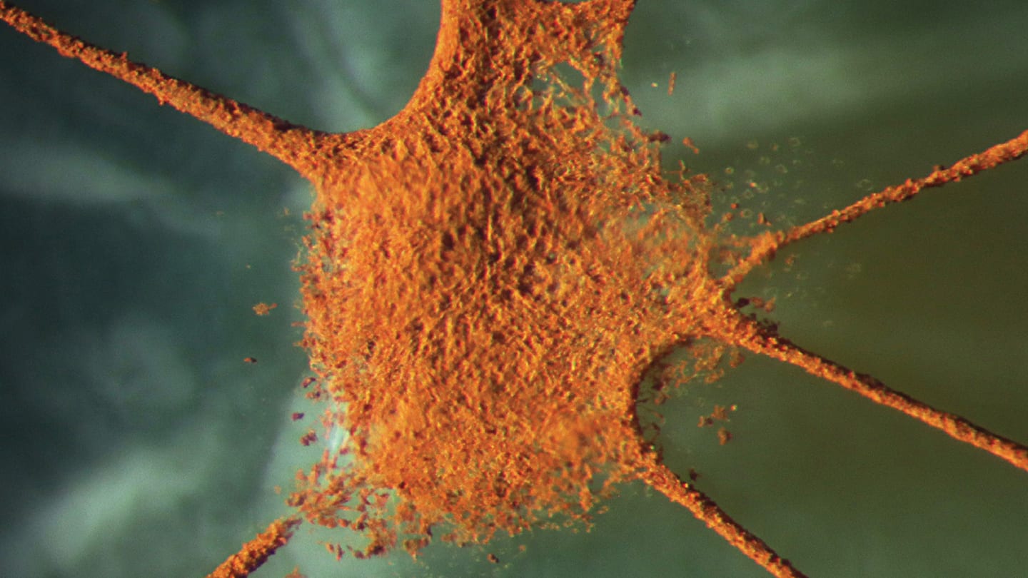 Haag-Streit Slit Lamp Imaging Competition 2026