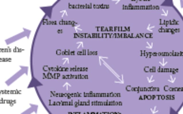 Current Treatment Options in Dry Eye Disease