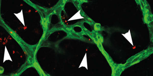 Retinal T-Regimen