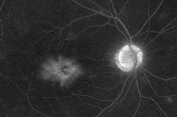 The Ophthalmologist’s Time Machine: Chapter 25