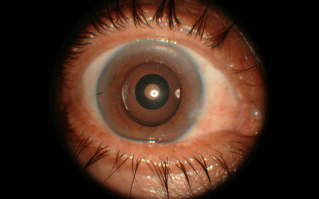 Extending Post-Operative Possibilities