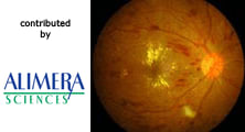 The Ophthalmologist and Alimera Sciences Announce Partnership (1)
