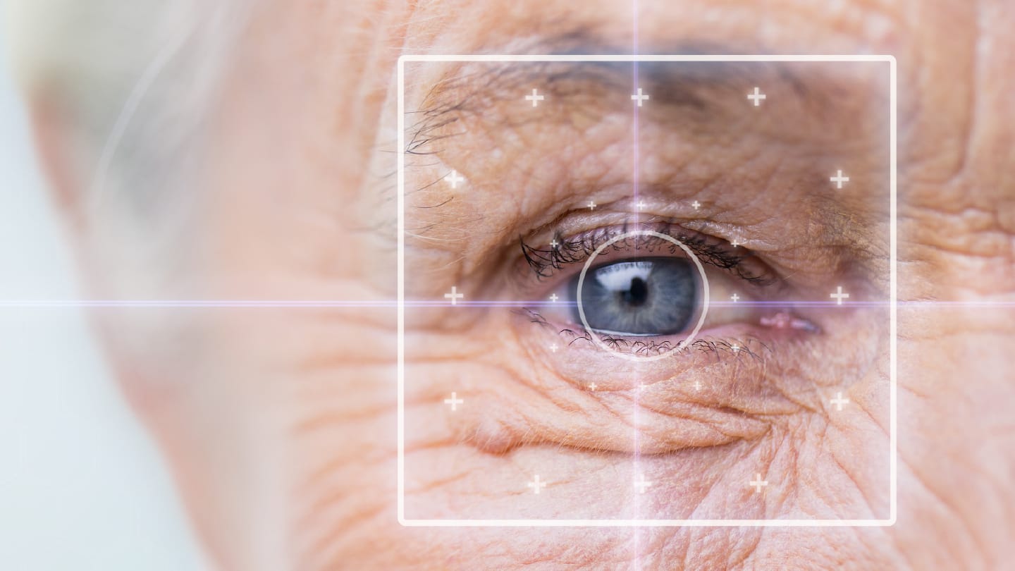 Glaucoma’s Compliance Gap