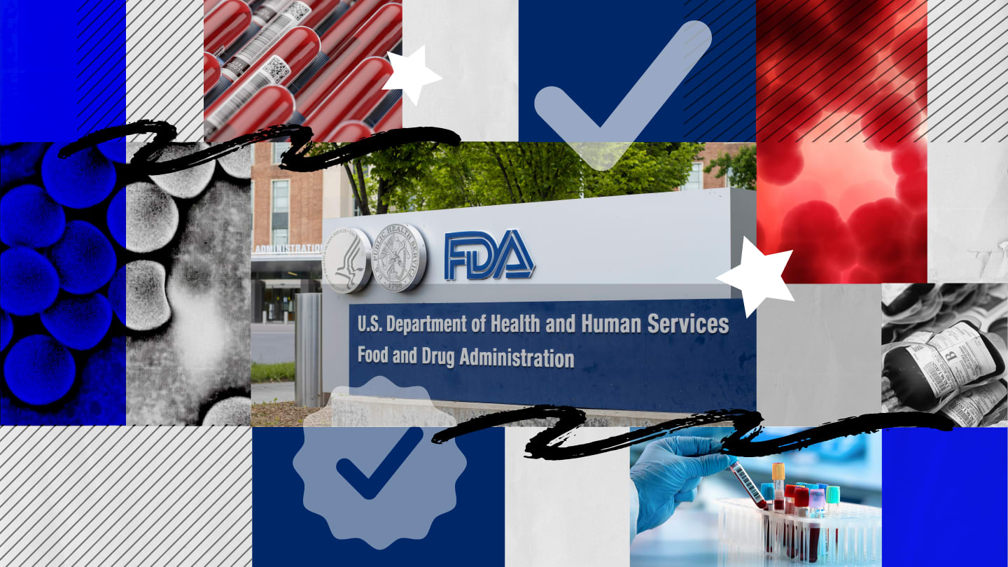 Once-Daily Eye Drop for IOP Enters FDA Review