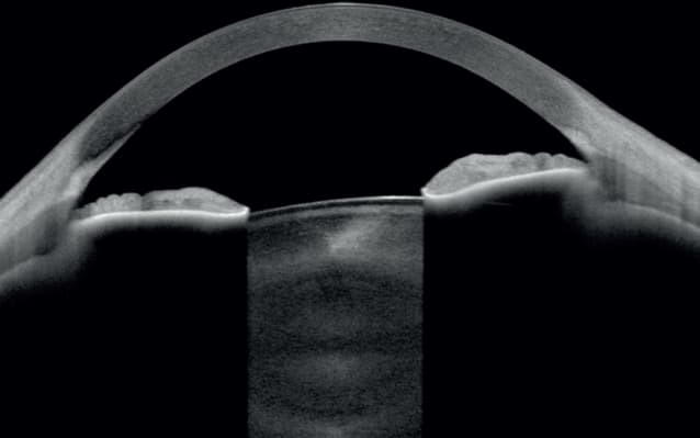 True Measurements, Fewer Assumptions