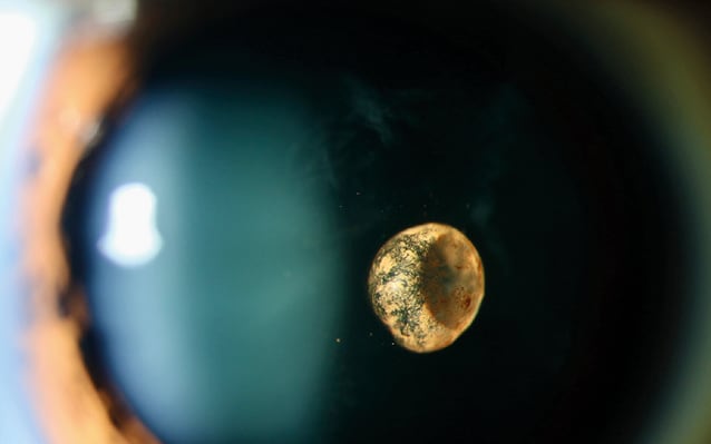 Imaging the Future